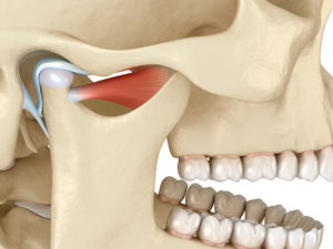Distúrbios temporomandibulares - Distúrbios da boca e dos dentes - Manual  MSD Versão Saúde para a Família