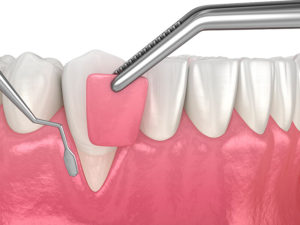 periodontia